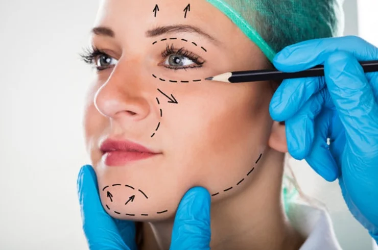 Cosmetic Surgery of Jaw & Face