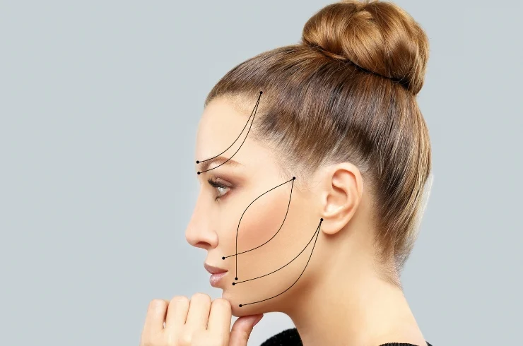 Skin Tightening & Surgical Face Lift---02